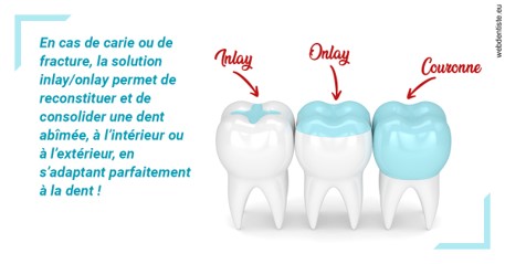 https://dr-christophe-schohn.chirurgiens-dentistes.fr/L'INLAY ou l'ONLAY