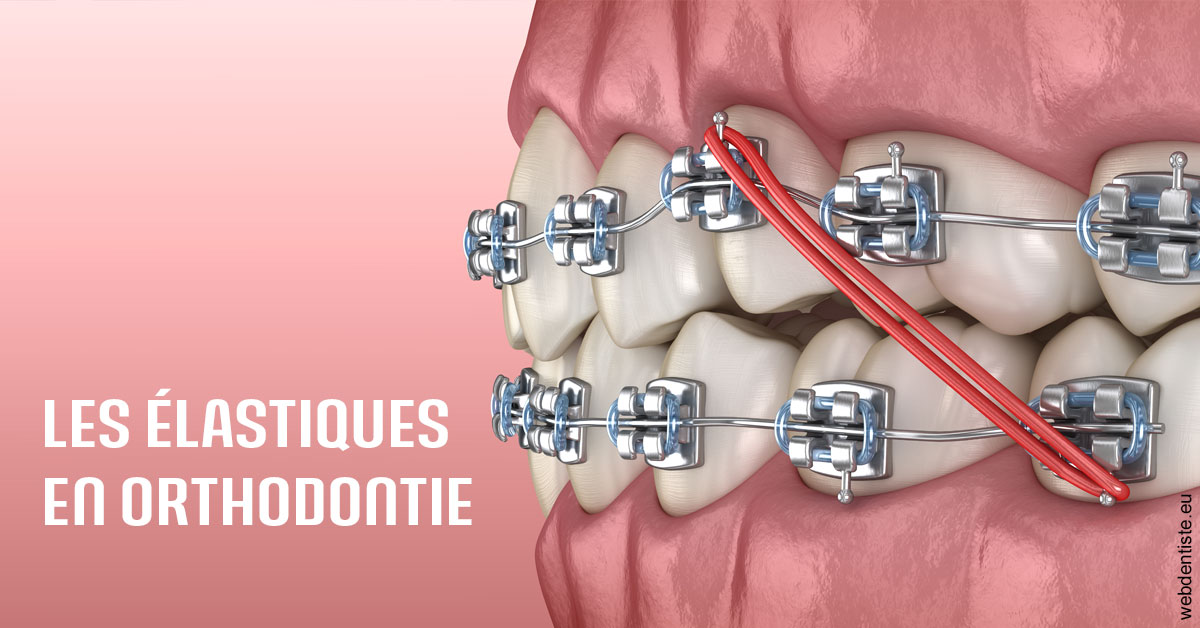 https://dr-christophe-schohn.chirurgiens-dentistes.fr/Elastiques orthodontie 2