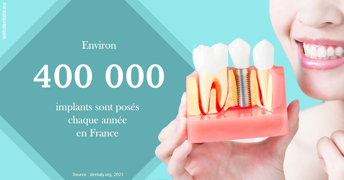 https://dr-christophe-schohn.chirurgiens-dentistes.fr/Pose d'implants en France 2